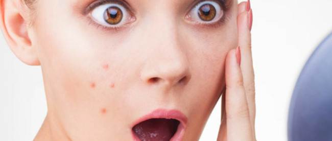 pimples-of-face-650x276